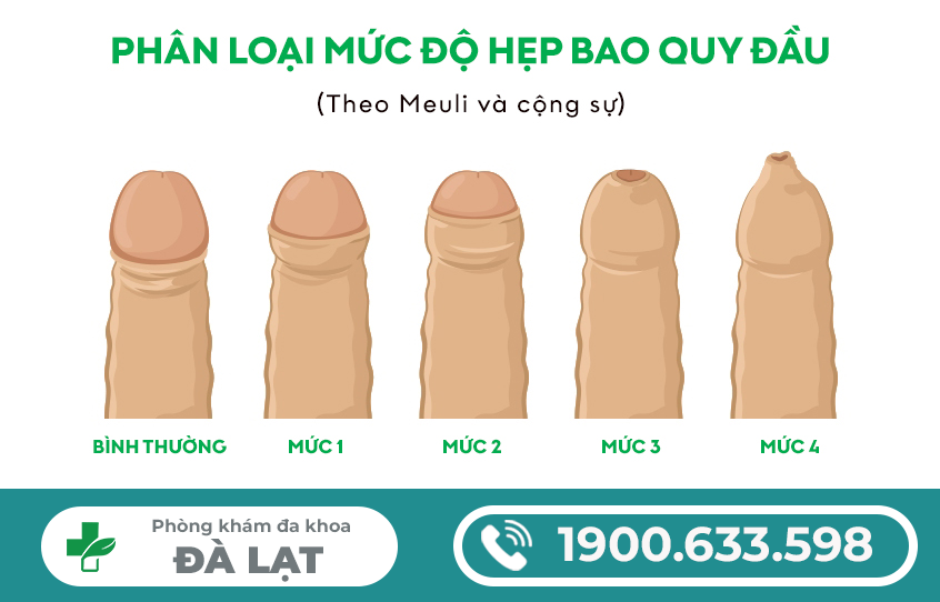 Hình ảnh minh họa